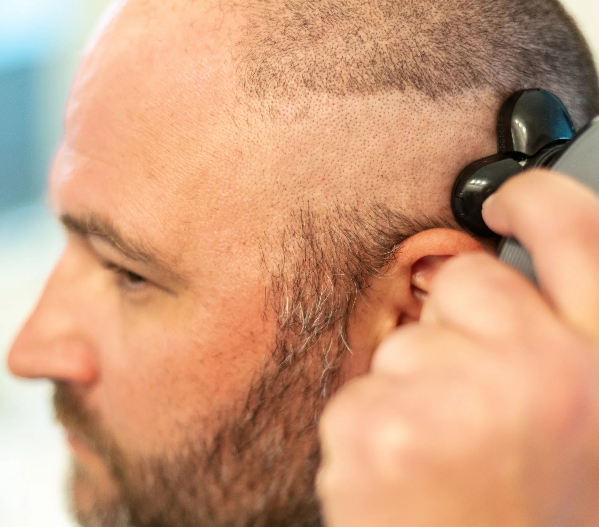 Head Shaving: Must-Have Shaver For Bald Guys